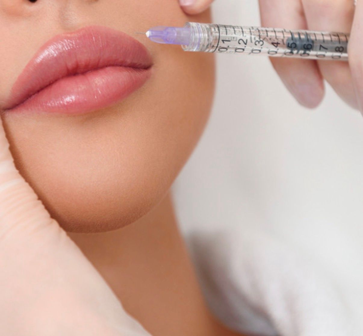 Dermal Fillers