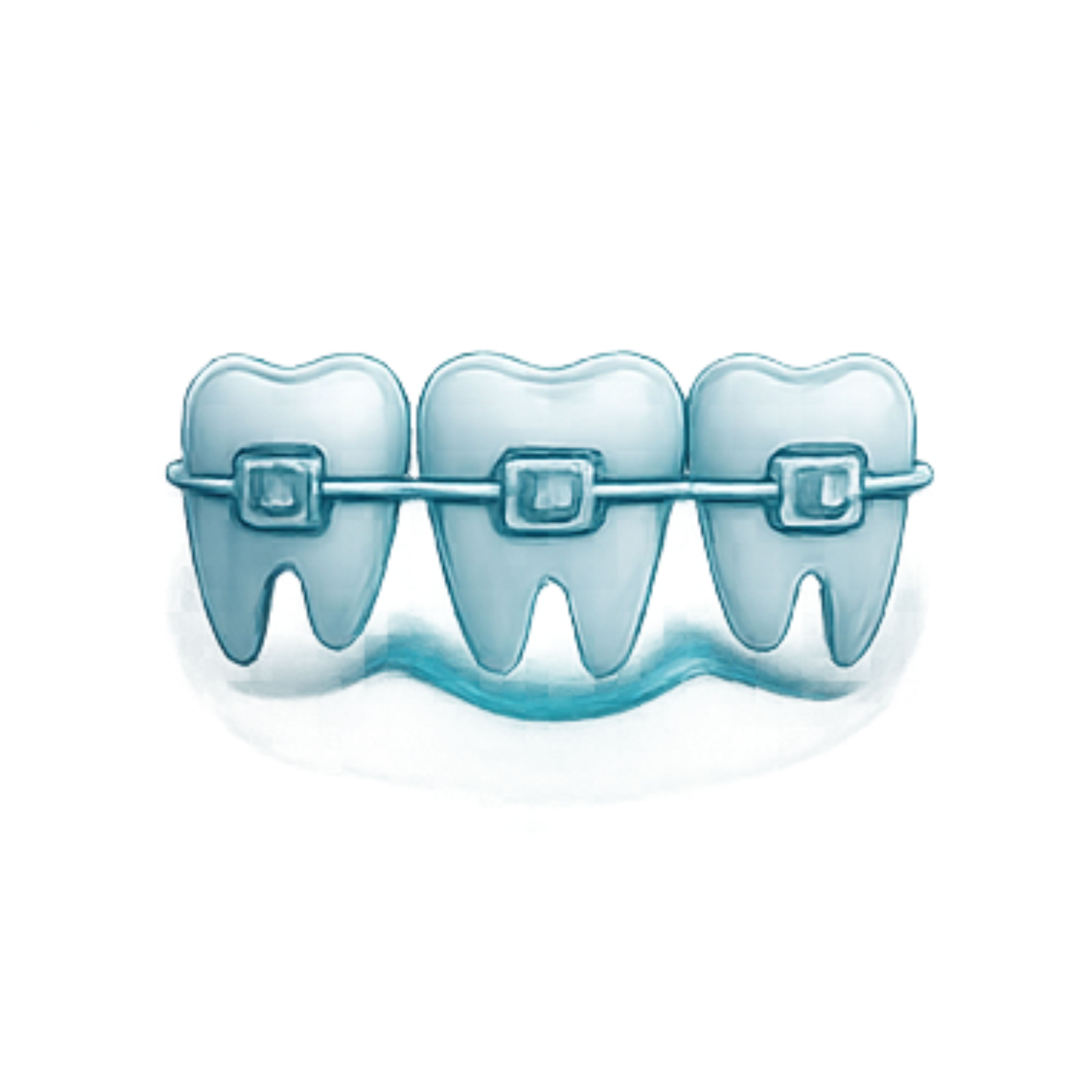 Orthodontic aligners illustration